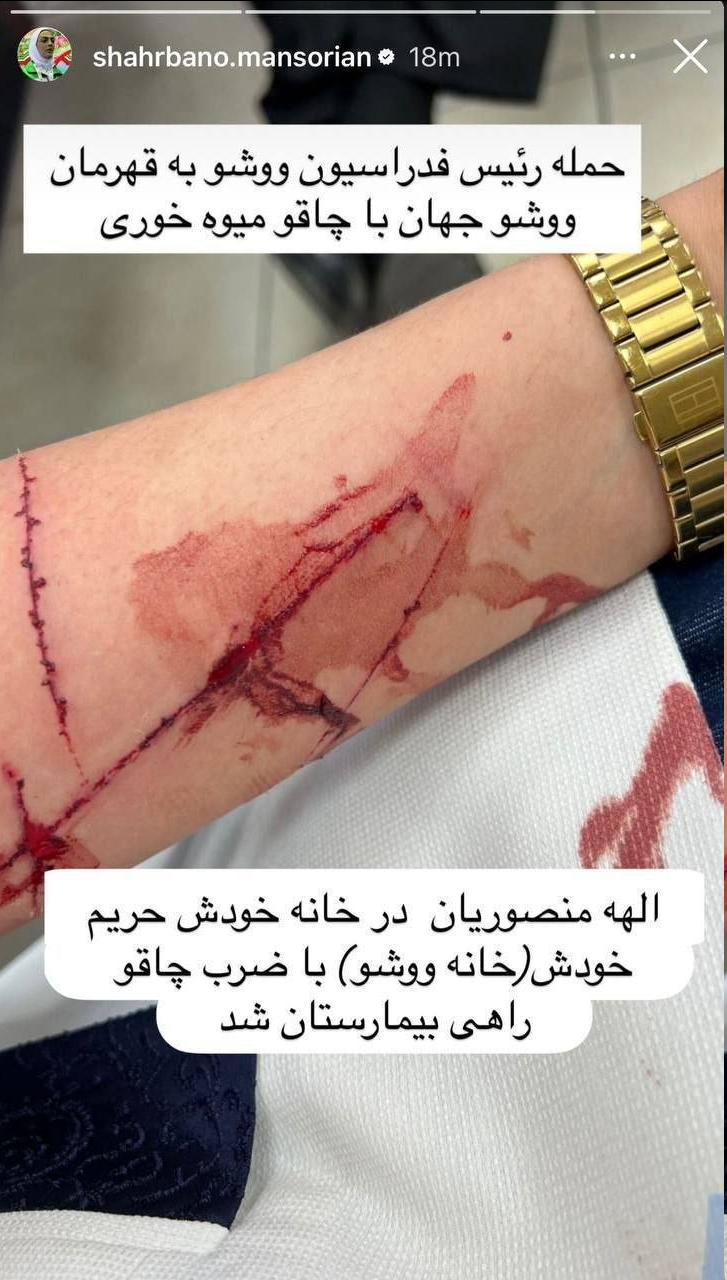 ادعای عجیب خواهران منصوریان پس از جنجال در فدراسیون!